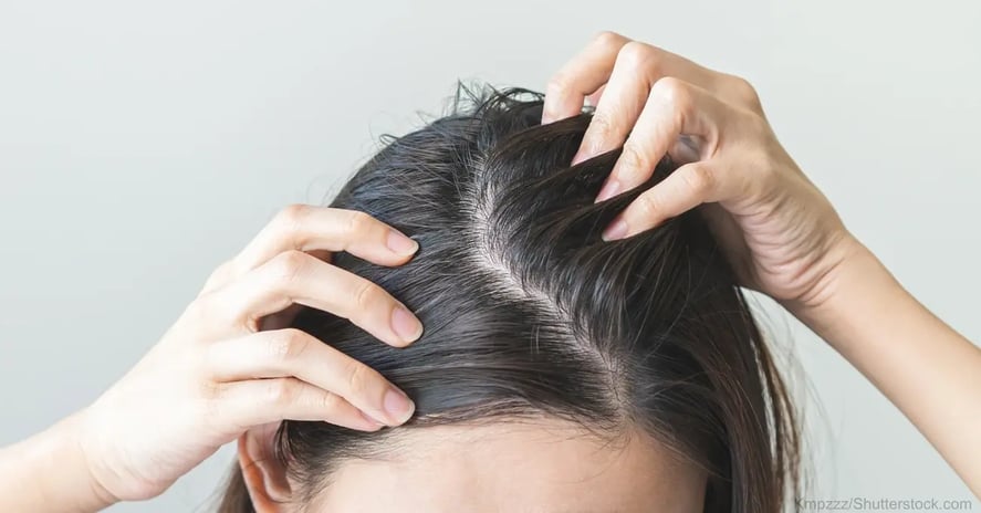 4dbcbdc2-83fe-4c83-a915-701920f766d0