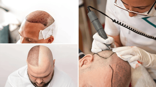 Bildschirmfoto 2025-11-17 um 09.33.43